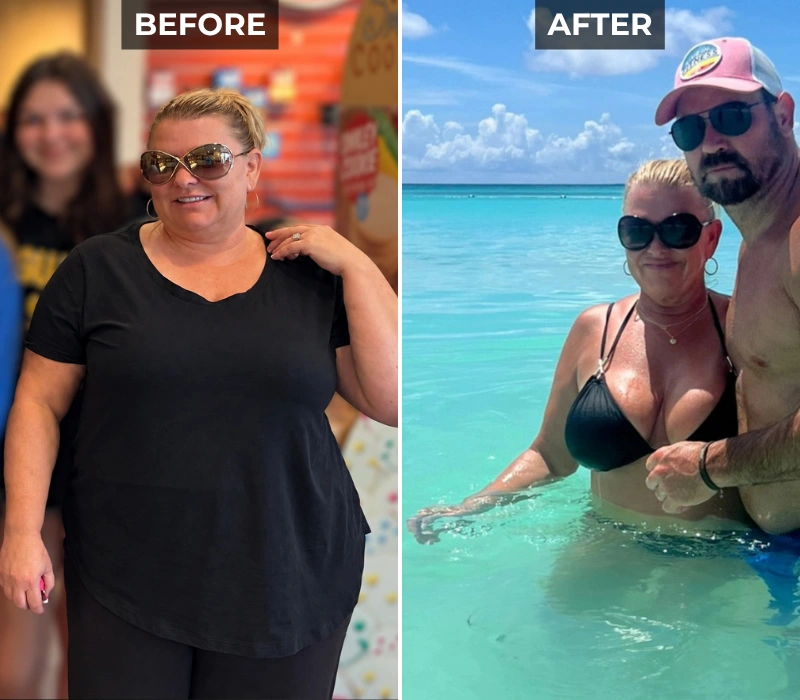 Sarah Before and After Weight Loss Transformation